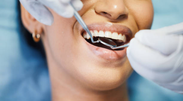 Best Dentist for Dental Trauma  in Country Clu, CA